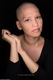 Robert Houser's portraits spotlight cancer patients as they reveal hair  loss and scars