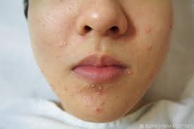 Why Knowing Your Skin Type Is Important