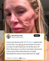 Brandi has responded to Dr Terry Dubrow offer to help. #rhobh #rhoc  #realhousewives #beverlyhills #orangecounty #realitytvshow #botched  #brandiglanville #drterrydubrow #realitytvnews #realitytvshow #gossip  #bravosnarkside