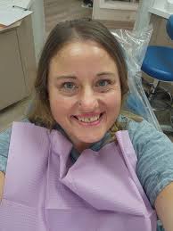 LIP-LIFT** * Smile is not only about dentistry. Sometimes if you want to  make the teeth looking longer, you just have to make the lip shorter. To  make the proper decision