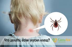 Chto Delat Esli Ukusil Klesh Dlya Vzroslyh Stati Terapiya Santalen