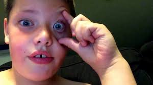 Check spelling or type a new query. How To Flip Your Eyelid And Make Your Eye Go Into The Back Of Your Head Youtube