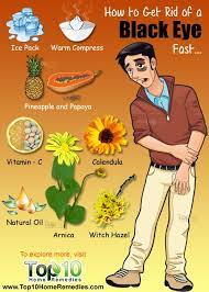 How To Get Rid Of A Black Eye As Fast As Possible Top 10 Home Remedies