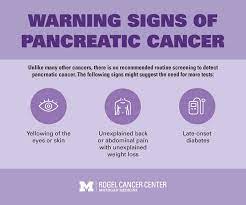 Radiation therapy surgery possible treatments include : Pancreatic Survival Rates Improving University Of Michigan Rogel Cancer Center