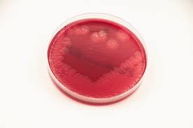 They are capsule positive (+ve), catalase negative, gelatin hydrolysis positive (+ve), gram positive bacteria. Brucella Blood Agar Bru Anaerobe Systems