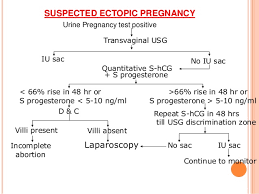 Ectopic Pregnancy