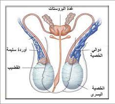 علاج دوالى الخصية مشاكل دوالي الخصيتين واساليب علاجها كلام حب