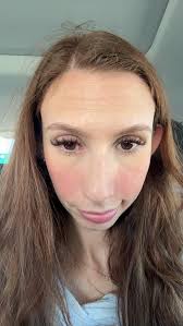 client came to me yesterday for a fill. She messaged me today and said one  eye was irritated and swollen. I then asked her if it was just under neath 