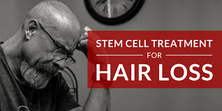 Hofling db, chavantes mc, et al. Progress In Stem Cell Treatment For Hair Loss Bioinformant