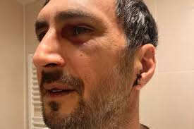 Man kidnapped at knifepoint and beaten