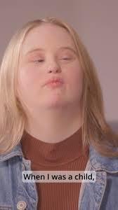 “The reason why I love acting is to bring joy to other people.” , Orla  Casey is an actress and is also secretary of the National Advisory Council  of Down Syndrome Ireland. , Support My Dreams is the ...