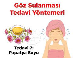 Goz Kurulugu Neden Olur Nasil Tedavi Edilir Gozler Saglik Doktorlar