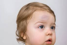 Immagini e foto stock di Bump