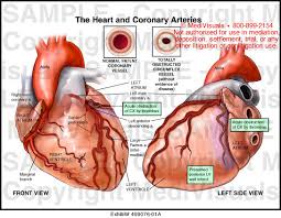 The left main coronary artery gives rise to the left anterior descending artery and the left circumflex coronary artery. Medivisuals The Heart And Coronary Arteries Medical Illustration