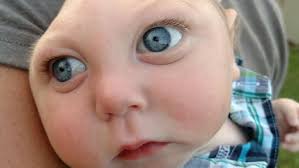 Jaxon Buell, Jaxon Strong, boy born with part of brain missing, dies at 5