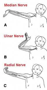 Outstanding Health Detail Are Offered On Our Web Pages Look At This And You Will Not Be Sorry You Did Health Median Nerve Massage Therapy Hand Therapy
