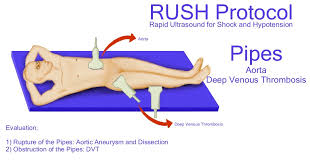 Rush grading is available upon completion of the exam. Rapid Ultrasound For Shock And Hypotension Rush Protocol Us Imaging Illustrations International Emergency Medicine Education Project