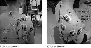Electrode Placement For Supraspinatus Infraspinatus Middle