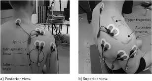 electrode placement for supraspinatus infraspinatus middle