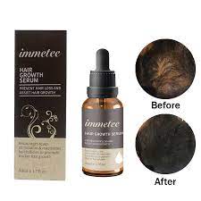 Organic hair growth products people usually look for aloe vera and coconut oil, as they are great for improving the general hair condition. Oem 100 Pure Organic Hair Repair Oil Hair Growth Serum Oil China Hair Growth Oil And Hair Repair Oil Price Made In China Com
