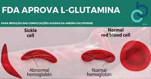 Resultado de imagem para anemia falciforme