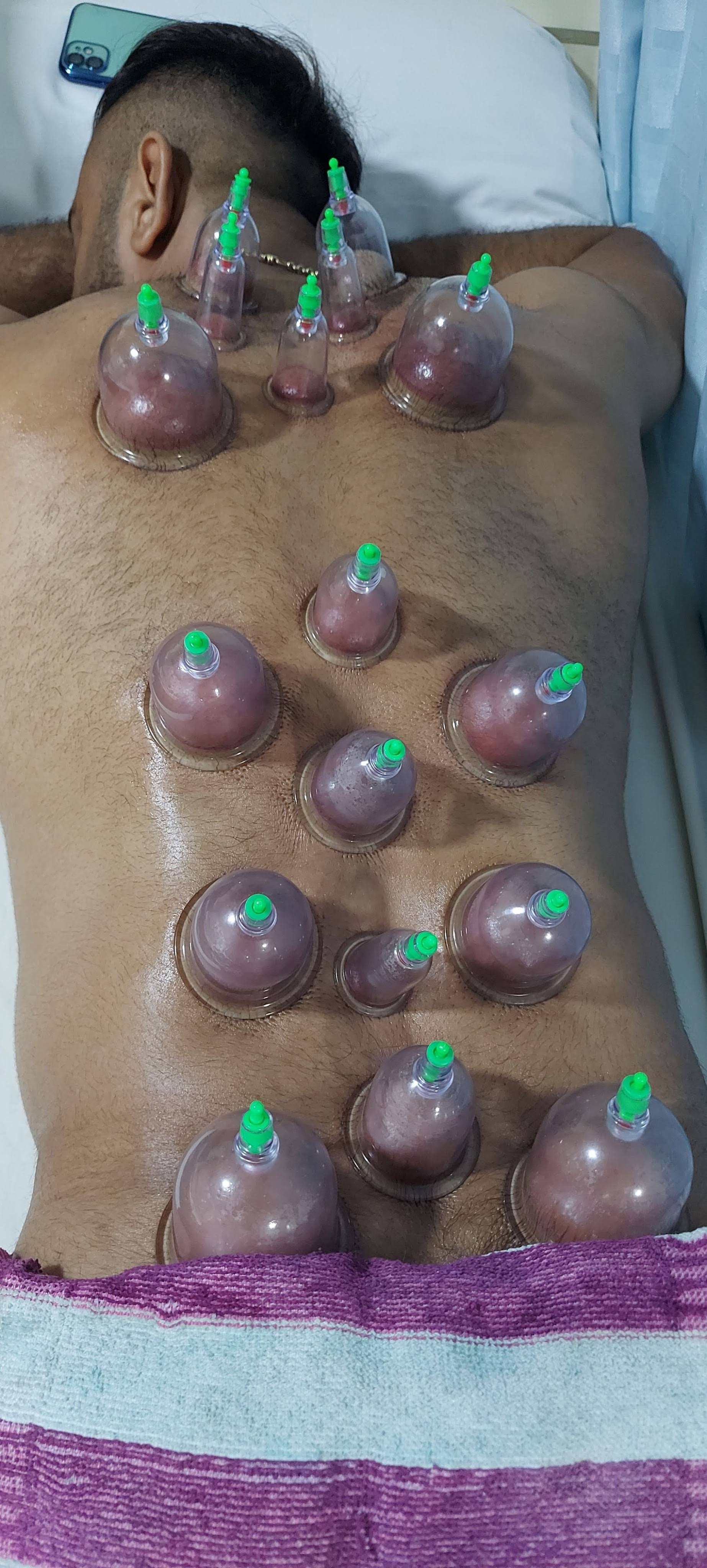 Cupping Therapy For Upper &Lower Back Pain. product image