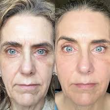 Use Castor Oil Before Bed