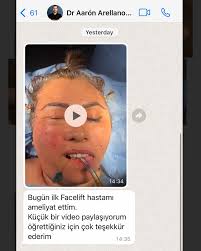 Dear Dr.Aaron Arellano is a great senior surgeon from Mexico 🇲🇽 and  @dr.aaronarellanoruiz visited us last weeks. He observed so many aesthetic  surgery operations such as scarless #facelift, #necklift, #rhinoplasty,  #Abdominoplasty, #breastreduction, #