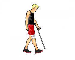 This instructional video shows how to correctly walk, sit, stand and go up and down stairs with crutches while putting partial weight on the injured leg. Walking After Acl Surgery Walking With One Crutch To Help Transition Back To Walking After An Acl Operation Acl Surgery Acl Recovery Acl Recovery Timeline
