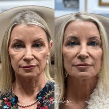 Exploring Life & Business with Robyn of Luna Skin and Aesthetics