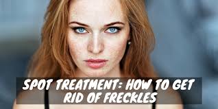 Growing up, i hated my freckles and wanted so badly to mask them. Spot Treatment How To Get Rid Of Freckles Skin Novus