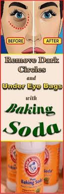 Remove Dark Circles Under Eye Bags Baking Soda Lemon Eyebags Eyebagsmakeup Eyebagsremova Baking Soda And Lemon Remove Dark Circles Baking Soda Mask