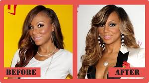 Captured for having different plastic surgeries which they did never confirm except tamar braxton who have . Tamar Plastic Surgery Before And After Www Bilderbeste Com