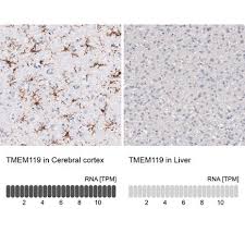This digital rat atlas is aimed at the whole rat. Anti Tmem119 Antibody Amab91528 Atlas Antibodies