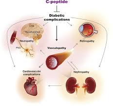 Type 1 diabetes mellitus (dm) is a multisystem disease with both biochemical and anatomic/structural consequences. Cara Mencegah Diabetes Melitus Bidanku Com