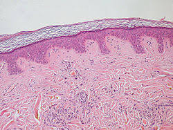 The dermis consists of two layers: Dermis Wikipedia