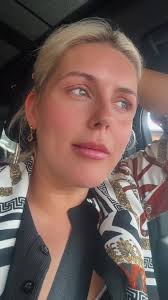 First time Botox shiny face pending✨