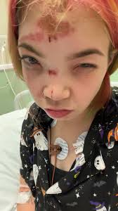 Introduction and living with epilepsy