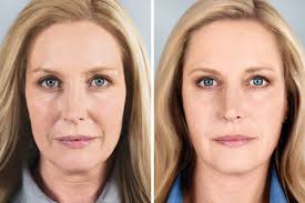 Vamos falar de novidades?! O...