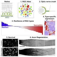 Operacija buvo sėkminga, dabar užtruks gal du mėnesius, kol galėsiu vėl vaikščioti be ramentų, galėsiu vairuoti. Single Cell Profiles Of Retinal Ganglion Cells Differing In Resilience To Injury Reveal Neuroprotective Genes Sciencedirect