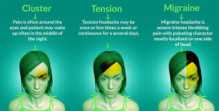 Image result for Acute Localized Headache