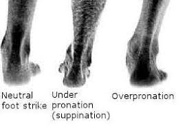 Overpronation Under Pronation Supination And Neutral Foot Getting The Right Running Shoe Get Your Foot Tested Peop Running Shoes Overpronation Running