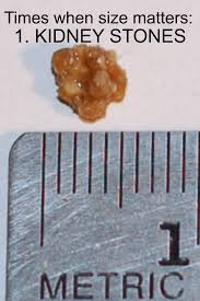 Pin On Kidney Love