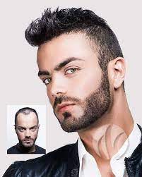Men S Non Surgical Hair Replacement Results Www Hrimn Com Thankgod4hri Hair Replacement Hair Loss Dramatic Hair