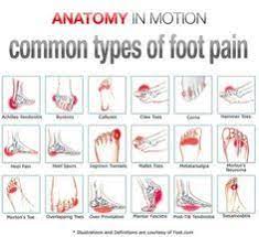 Bottom foot pain diagnosis chart. Foot Pain Chart