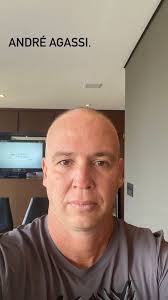 Caio Ribeiro posta foto careca após início de tratamento contra câncer