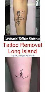 Can You Get Laser Tattoo Removal While Breastfeeding Where Do People Get Tattoos Removed From The Mo Eyebrow Tattoo Removal Tattoo Removal Results Laser Tattoo