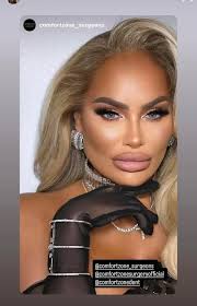 The next Bond girl? ❤️‍🔥 comfortzone_surgeons Gcomfortzone surgeons  @comfortzonesurgeryofficial @comfortzonedent