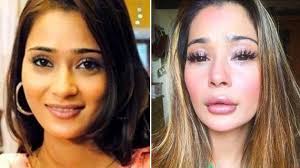 Gone are the days when you could spot somebody who had plastic surgery procedures with ease. Sara Khan Trolled For Plastic Surgery Gone Wrong Actor Says She Loves Her Lip Job See Pics Hindustan Times