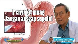 Check spelling or type a new query. Apa Itu Penyakit Maag Ini Penyebab Dan Gejalanya Youtube